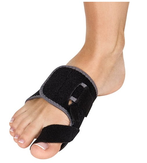 hallux valgus